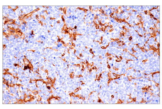 Immunohistochemistry Image 4: CD38 (E9F5A) XP<sup>®</sup> Rabbit mAb
