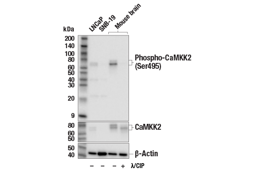 Western Blotting Image 1: Phospho-CaMKK2 (Ser495) (E7W9S) Rabbit mAb