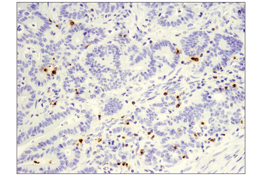 undefined Image 28: Human Exhausted CD8<sup>+</sup> T Cell IHC Antibody Sampler Kit