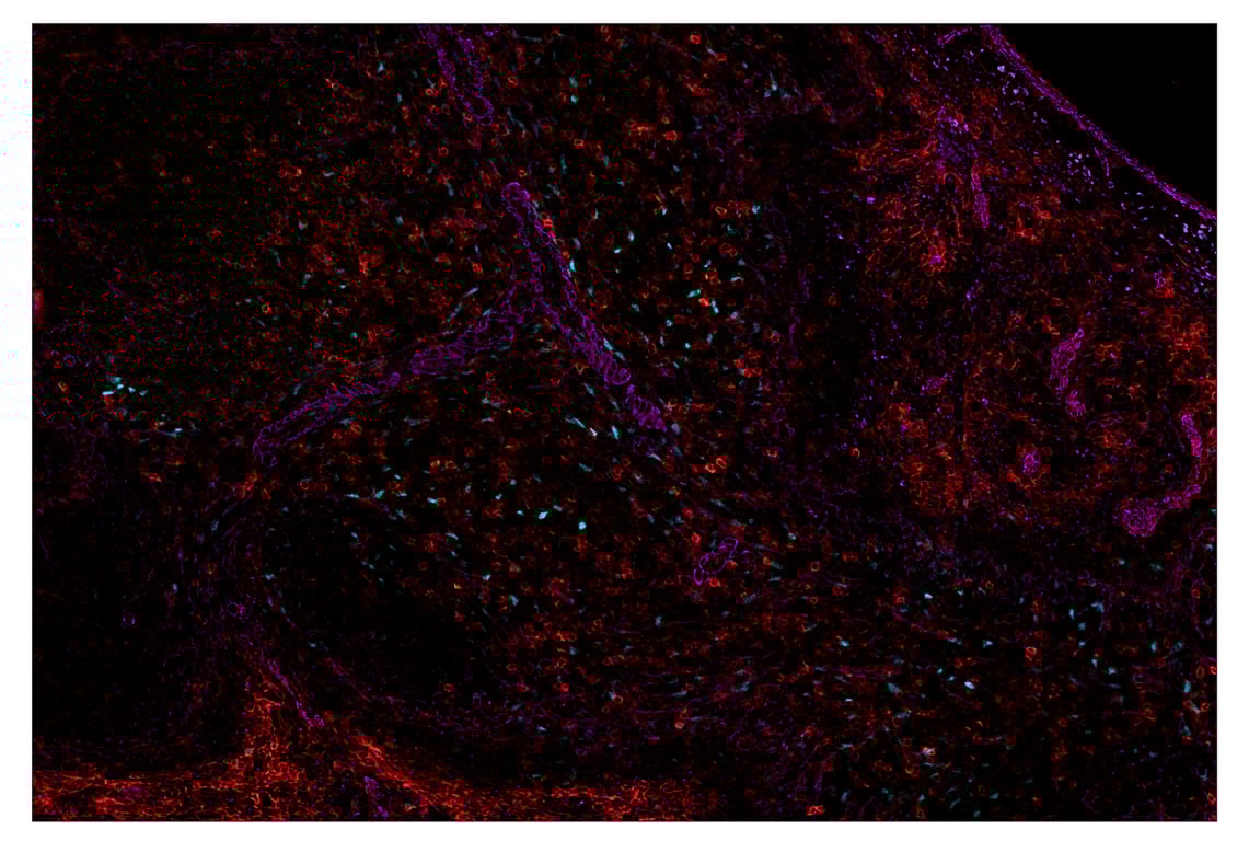 Immunohistochemistry Image 2: NT5E/CD73 (D7F9A) & CO-0039-750 SignalStar<sup>™</sup> Oligo-Antibody Pair