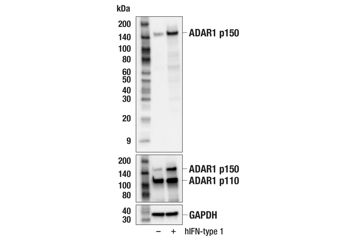 Western Blotting Image 2: ADAR1 p150 Isoform   (E6U1U) Rabbit mAb   (BSA and Azide Free)