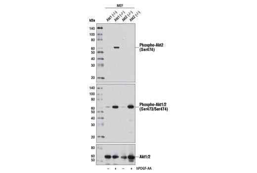 undefined Image 30: Phospho-Akt Isoform Antibody Sampler Kit