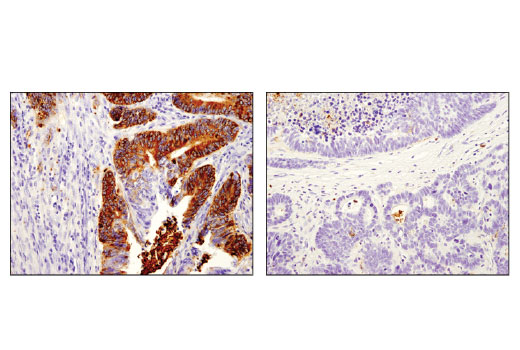 Immunohistochemistry Image 2: OLFM4 (D1E4M) XP<sup>®</sup> Rabbit mAb