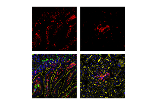 Immunofluorescence Image 1: CD45 (D3F8Q) Rabbit mAb (Alexa Fluor<sup>®</sup> 647 Conjugate)