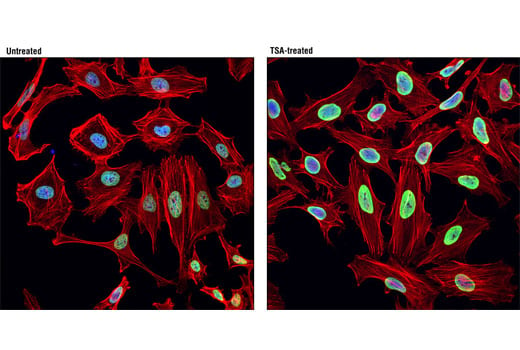 Immunofluorescence Image 1: Acetyl-Histone H2B (Lys15) (D8H1) XP<sup>®</sup> Rabbit mAb