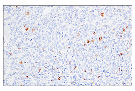 Immunohistochemistry Image 1: 4-1BB/CD137/TNFRSF9 (E6Z7F) XP<sup>®</sup> Rabbit mAb