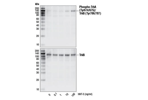 undefined Image 4: Human Neurotrophin-3 (hNT-3)