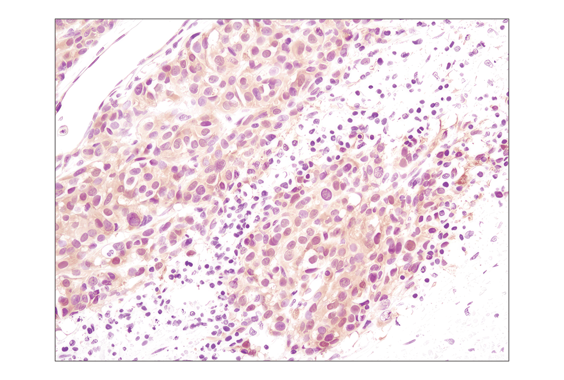 Immunohistochemistry Image 1: Akt (pan) (C67E7) Rabbit mAb