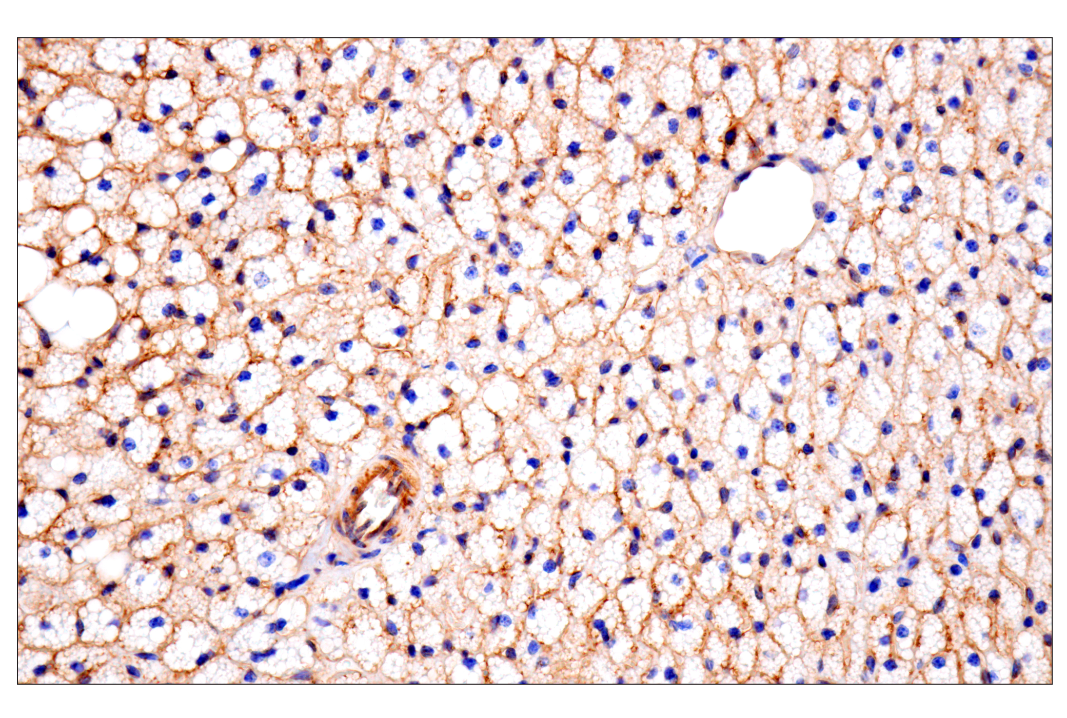 Immunohistochemistry Image 6: CD81 (D5O2Q) Rabbit mAb