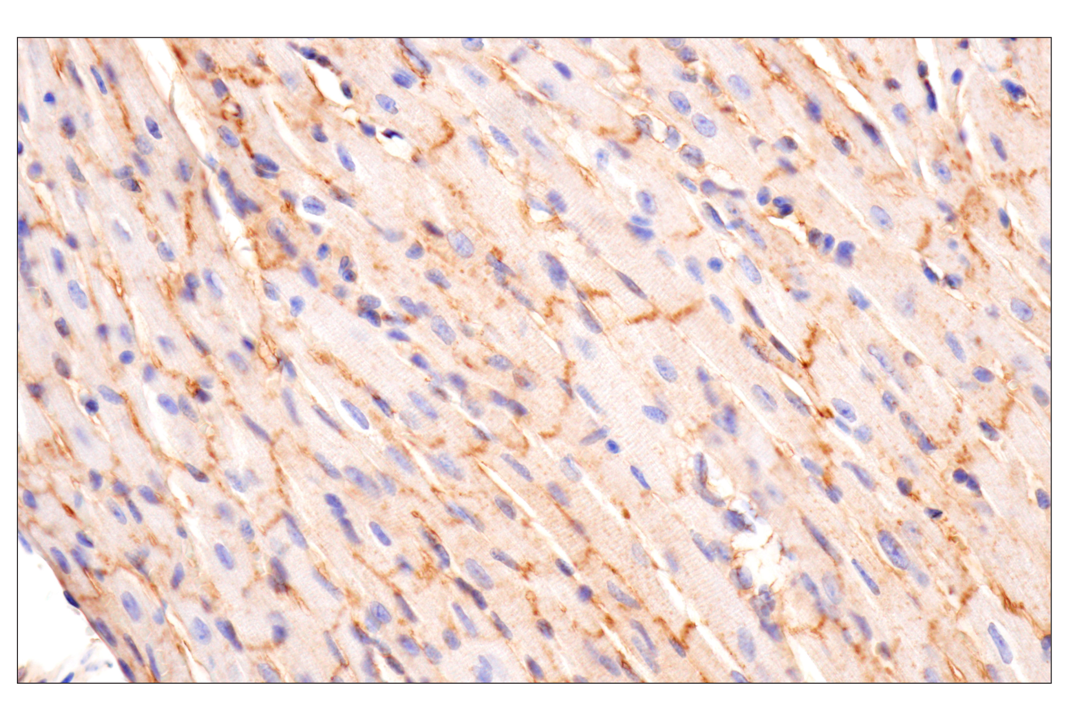 Immunohistochemistry Image 8: CD81 (D5O2Q) Rabbit mAb