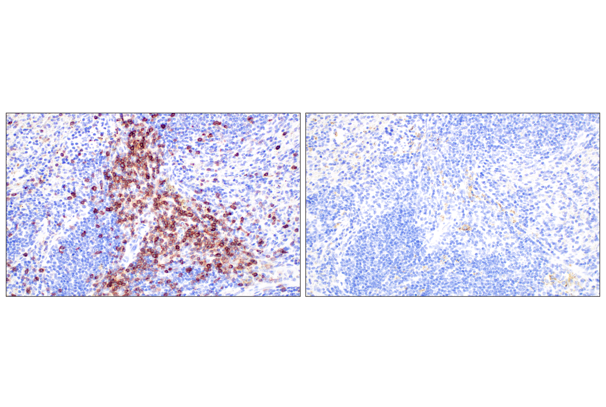Immunohistochemistry Image 5: CD5 (E6N9S) Rabbit mAb