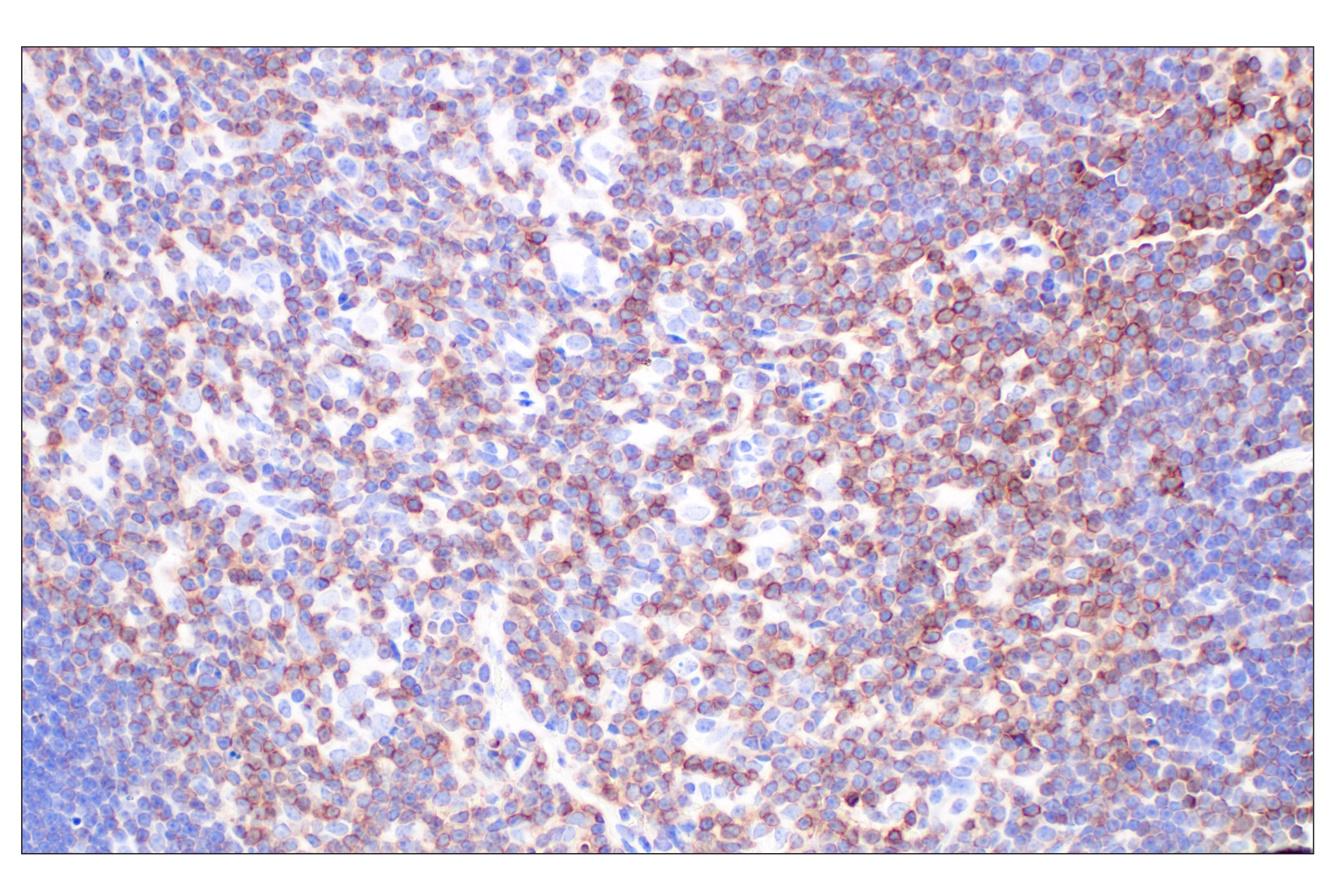 Immunohistochemistry Image 1: CD5 (E6N9S) Rabbit mAb