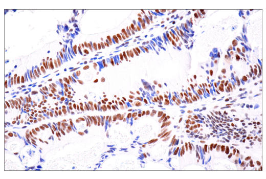 Immunohistochemistry Image 2: ATRX (E5X7O) Rabbit mAb