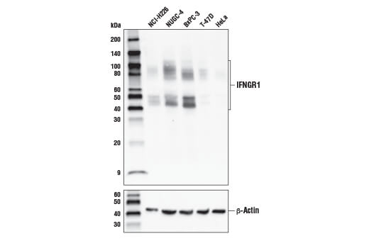  Image 3: MHC Class I Antigen Processing and Presentation Antibody Sampler Kit