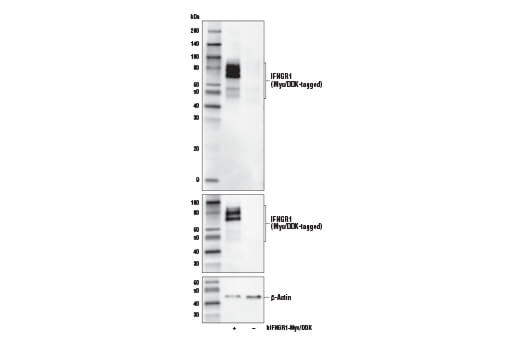  Image 12: MHC Class I Antigen Processing and Presentation Antibody Sampler Kit