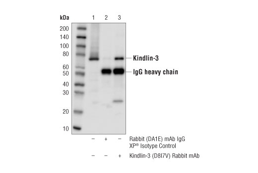 Immunoprecipitation Image 1: Kindlin-3 (D8I7V) Rabbit mAb