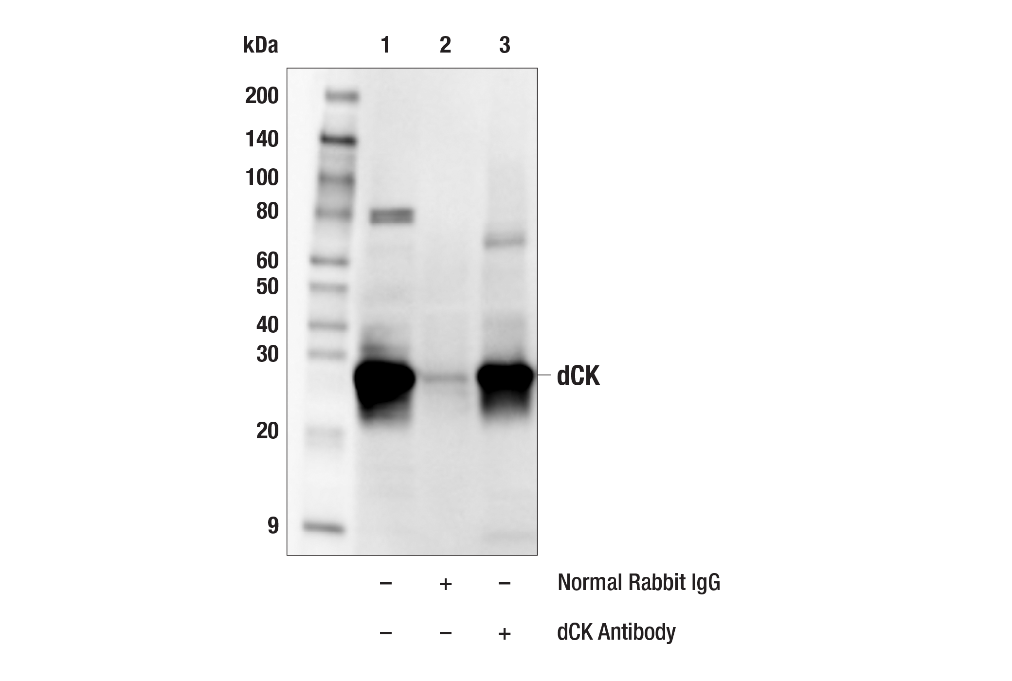 Immunoprecipitation Image 1: dCK Antibody