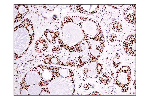 Immunohistochemistry Image 8: Ape1 (E5Y2C) Rabbit mAb