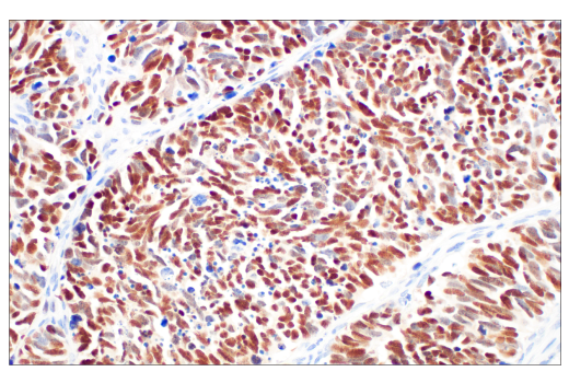  Image 8: Small Cell Lung Cancer Biomarker Antibody Sampler Kit