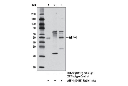  Image 16: ER Homeostasis Antibody Sampler Kit