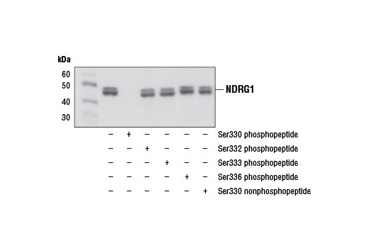  Image 11: NDRG Family Antibody Sampler Kit