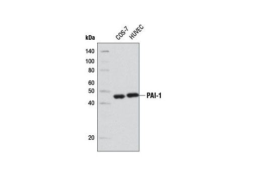  Image 2: Senescence Associated Secretory Phenotype (SASP) Antibody Sampler Kit