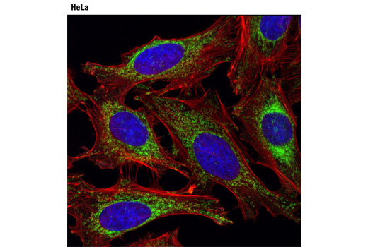  Image 18: Mitochondrial Dynamics Antibody Sampler Kit