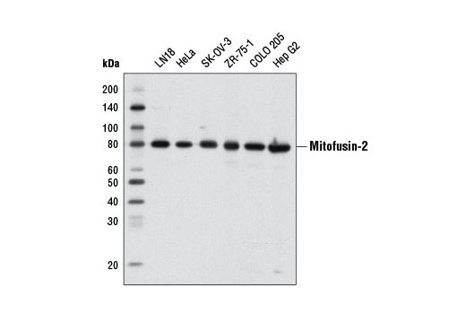  Image 1: Mitochondrial Dynamics Antibody Sampler Kit