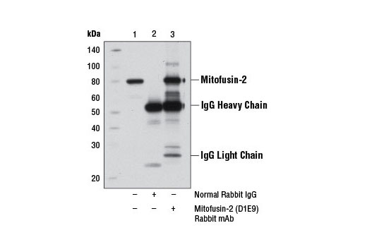  Image 10: Mitochondrial Dynamics Antibody Sampler Kit