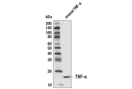  Image 12: Mouse Reactive Senescence Associated Secretory Phenotype (SASP) Antibody Sampler Kit