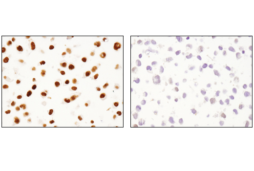  Image 32: BAF Complex IHC Antibody Sampler Kit