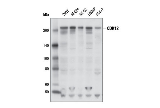 Western Blotting Image 1: CDK12 Antibody