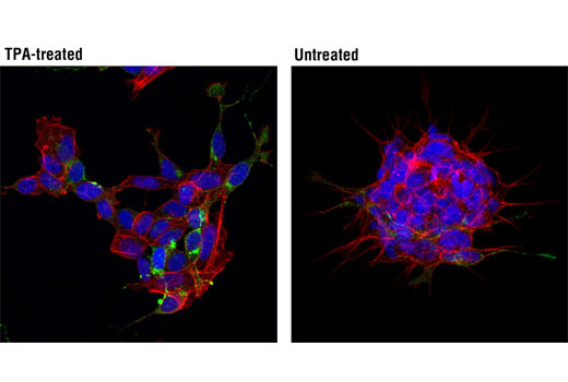 Immunofluorescence Image 2: Neuropeptide Y (D7Y5A) XP® Rabbit mAb