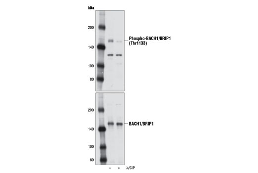 Western Blotting Image 1: Phospho-BACH1/BRIP1 (Thr1133) Antibody