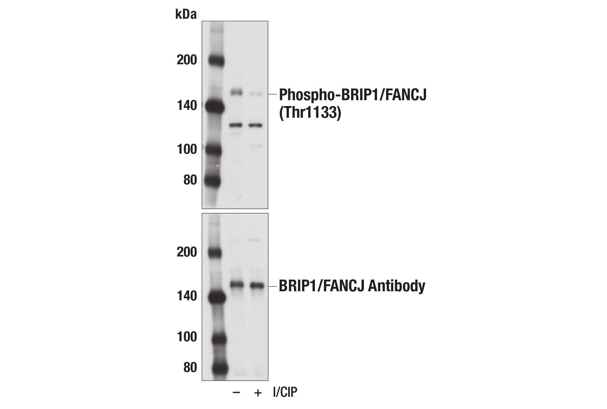 Western Blotting Image 1: Phospho-BRIP1/FANCJ (Thr1133) Antibody