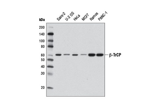  Image 2: Ubiquitin E3 Ligase Complex Antibody Sampler Kit