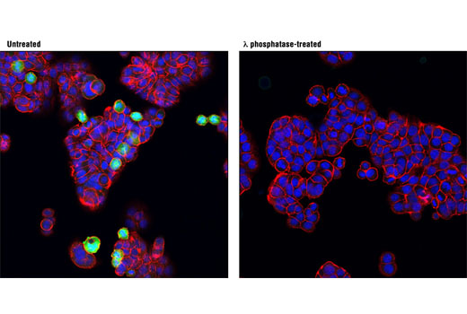 Immunofluorescence Image 1: Phospho-cdc25C (Thr48) (D2H3) Rabbit mAb
