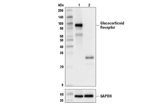  Image 23: Steroid Hormone Receptor Antibody Sampler Kit