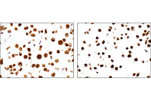  Image 43: Steroid Hormone Receptor Antibody Sampler Kit