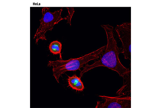 Immunofluorescence Image 1: Aurora A (1F8) Mouse mAb