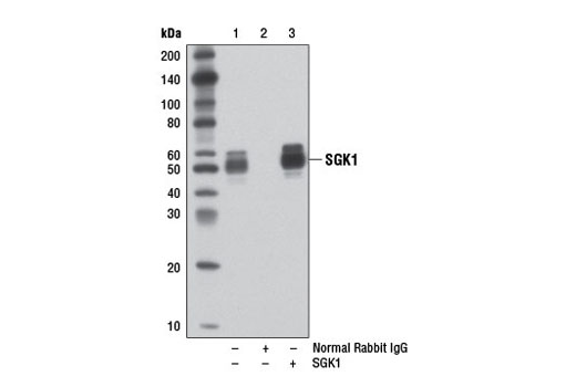 Immunoprecipitation Image 1: SGK1 (D27C11) Rabbit mAb