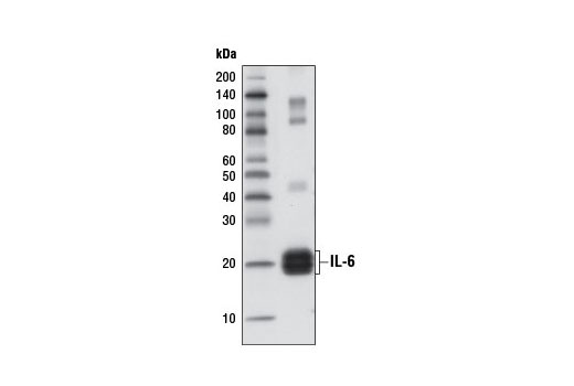  Image 3: Senescence Associated Secretory Phenotype (SASP) Antibody Sampler Kit