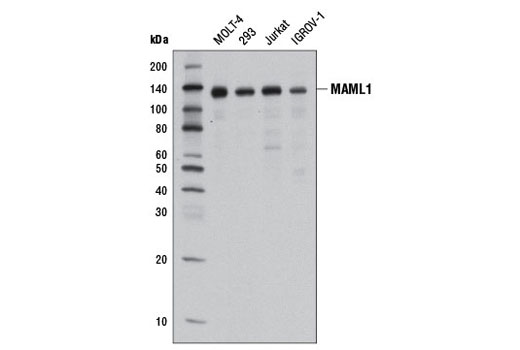  Image 4: Notch Activated Targets Antibody Sampler Kit