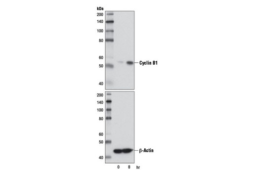  Image 12: Cell Cycle Regulation Antibody Sampler Kit II