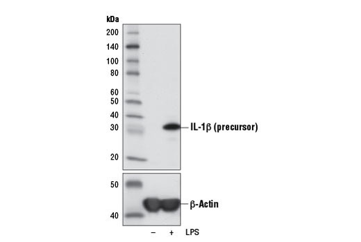 Western Blotting Image 1: IL-1β (3A6) Mouse mAb
