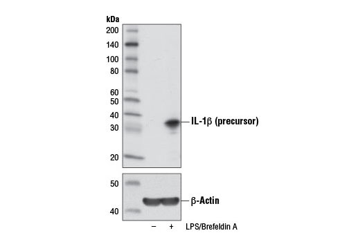 Western Blotting Image 2: IL-1β (3A6) Mouse mAb