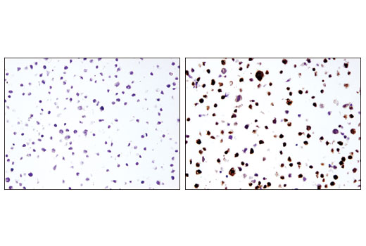  Image 25: Mouse Reactive Senescence Associated Secretory Phenotype (SASP) Antibody Sampler Kit
