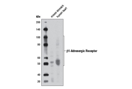 Western Blotting Image 1: β1-Adrenergic Receptor Antibody 