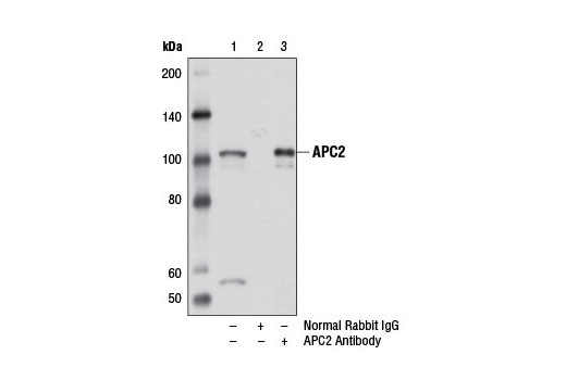 Immunoprecipitation Image 1: APC2 Antibody