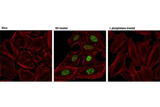  Image 9: PhosphoPlus® Chk1 (Ser317) Antibody Duet